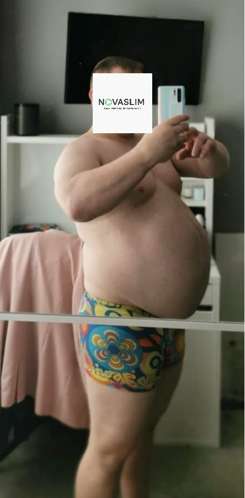 Paul - 38 - Male - Before