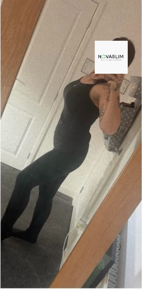 Liz - 35 - Female - After