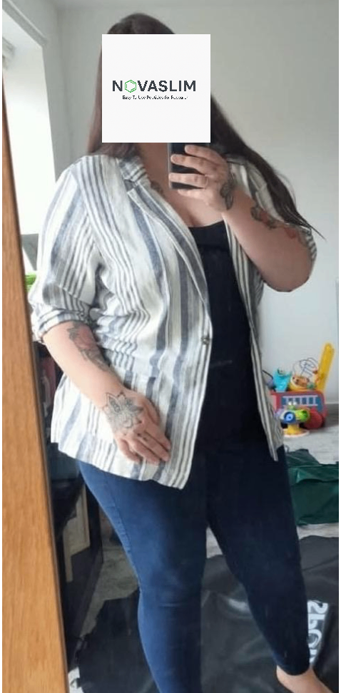 Liz - 35 - Female - Before